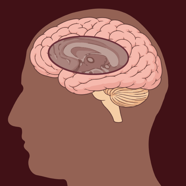 Pineal gland