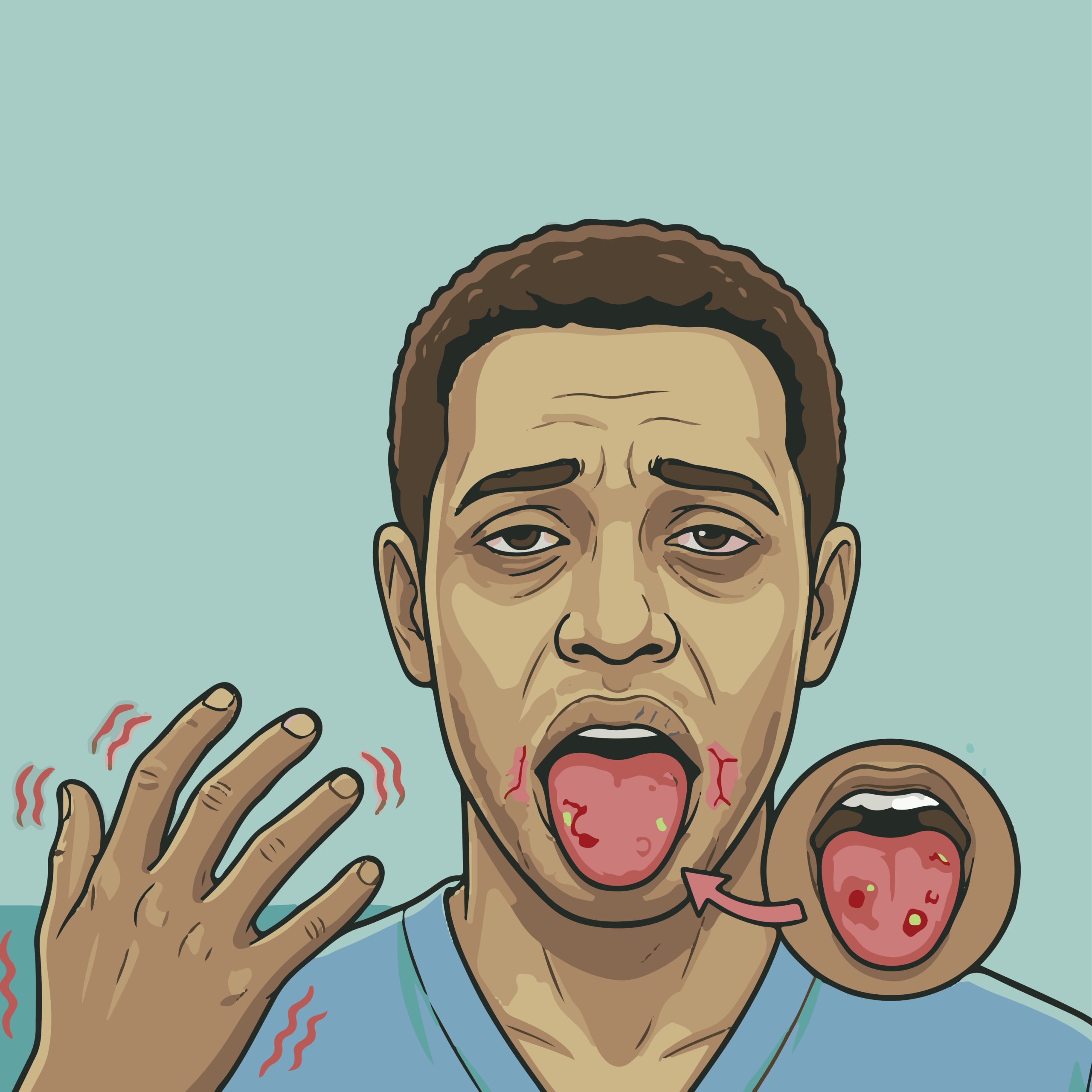 Vitamin B12 deficiency